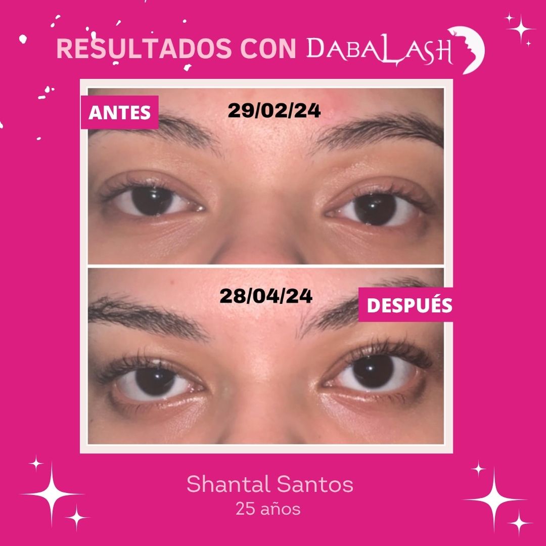 Testimonios de crecimiento de pesta&ntilde;as 